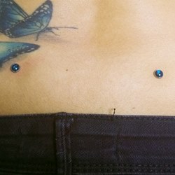 Microdermals