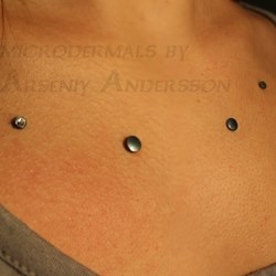 Microdermals