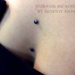 Sternum microdermals