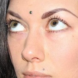 Third eye microdermal