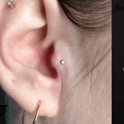 Прокол козелка (tragus)